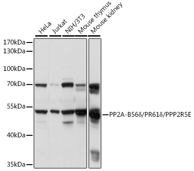 Western blot analysis of extracts of various cell lines using PP2A-B56δ/PR61δ/PPP2R5E Polyclonal Antibody at 1:1000 dilution.