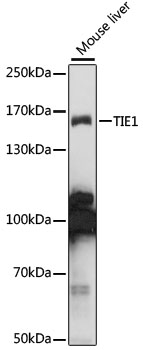 Western blot analysis of extracts of mouse liver using TIE1 Polyclonal Antibody at 1:1000 dilution.