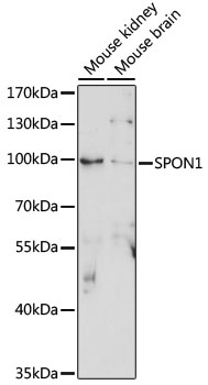 Western blot analysis of extracts of various cell lines using SPON1 Polyclonal Antibody at 1:1000 dilution.