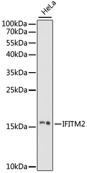 Western blot analysis of extracts of HeLa cells using IFITM2 Polyclonal Antibody at 1:1000 dilution.