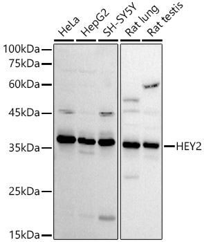 Western blot analysis of various lysates using HEY2 Polyclonal Antibody at 1:1000 dilution.