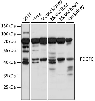 Western blot analysis of extracts of various cell lines using PDGFC Polyclonal Antibody at 1:1000 dilution.