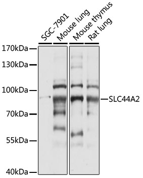 Western blot analysis of extracts of various cell lines using SLC44A2 Polyclonal Antibody at 1:1000 dilution.