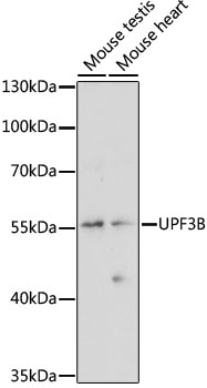 Western blot analysis of extracts of various cell lines using UPF3B Polyclonal Antibody at 1:1000 dilution.