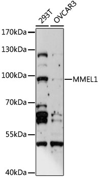 Western blot analysis of extracts of various cell lines using MMEL1 Polyclonal Antibody at 1:1000 dilution.