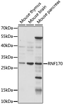 Western blot analysis of extracts of various cell lines using RNF170 Polyclonal Antibody at 1:1000 dilution.