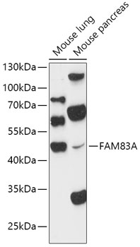 Western blot analysis of extracts of various cell lines using FAM83A Polyclonal Antibody at 1:1000 dilution.