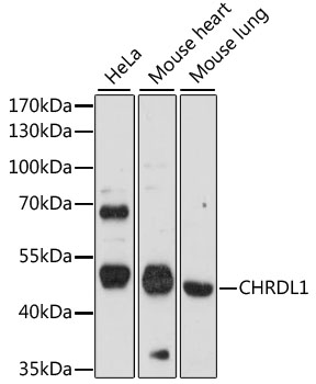 Western blot analysis of extracts of various cell lines using CHRDL1 Polyclonal Antibody at 1:1000 dilution.