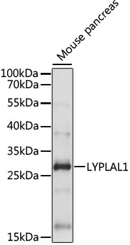 Western blot analysis of extracts of Mouse pancreas using LYPLAL1 Polyclonal Antibody at 1:1000 dilution.