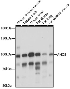 Western blot analysis of extracts of various cell lines using ANO5 Polyclonal Antibody at 1:1000 dilution.