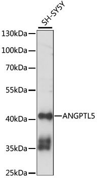 Western blot analysis of extracts of SH-SY5Y cells using ANGPTL5 Polyclonal Antibody at 1:1000 dilution.