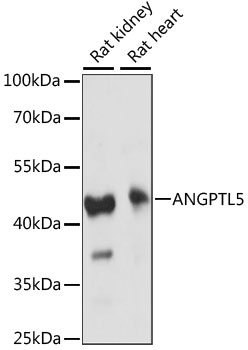 Western blot analysis of extracts of various cell lines using ANGPTL5 Polyclonal Antibody at 1:1000 dilution.