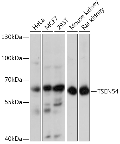 Western blot analysis of extracts of various cell lines using TSEN54 Polyclonal Antibody at1:3000 dilution.