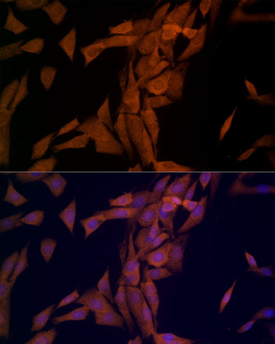 Immunofluorescence analysis of NIH/3T3 cells using OTUD4 Polyclonal Antibody at dilution of 1:200 (40x lens). Blue: DAPI for nuclear staining.