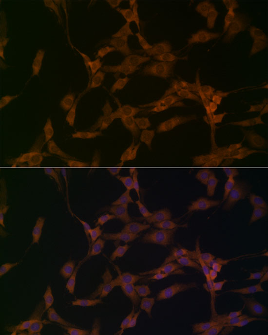 Immunofluorescence analysis of PC-12 cells using OTUD4 Polyclonal Antibody at dilution of 1:200 (40x lens). Blue: DAPI for nuclear staining.