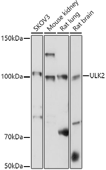 Western blot analysis of extracts of various cell lines using ULK2 Polyclonal Antibody at 1:1000 dilution.