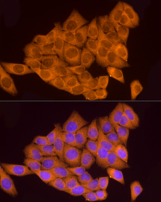 Immunofluorescence analysis of HeLa using ATP6V0A1 Polyclonal Antibody at dilution of 1:100. Blue: DAPI for nuclear staining.