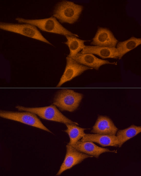 Immunofluorescence analysis of NIH/3T3 using ATP6V0A1 Polyclonal Antibody at dilution of 1:100. Blue: DAPI for nuclear staining.