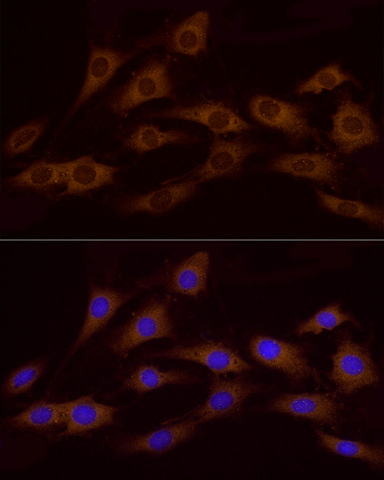 Immunofluorescence analysis of C6 using ATP6V0A1 Polyclonal Antibody at dilution of 1:100. Blue: DAPI for nuclear staining.