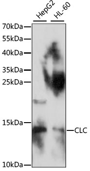 Western blot analysis of extracts of various cell lines using CLC Polyclonal Antibody at 1:1000 dilution.