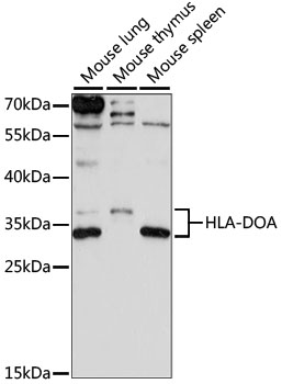 Western blot analysis of extracts of various cell lines using HLA-DOA Polyclonal Antibody at 1:1000 dilution.