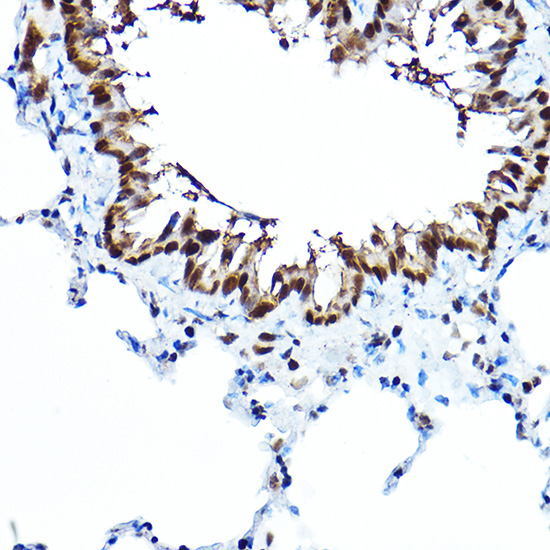 Immunohistochemistry of paraffin-embedded rat lung using FOXA1 Polyclonal Antibody at dilution of 1:100 (40x lens).Perform high pressure antigen retrieval with 10 mM citrate buffer pH 6.0 before commencing with IHC staining protocol.