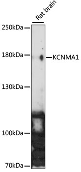 Western blot analysis of extracts of Rat brain using KCNMA1 Polyclonal Antibody at 1:1000 dilution.