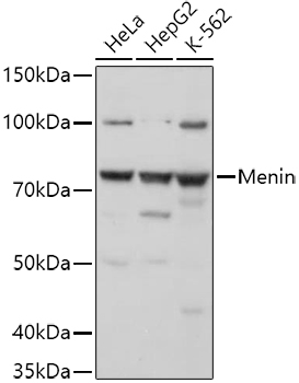 Western blot analysis of extracts of various cell lines using Menin Polyclonal Antibody at 1:1000 dilution.