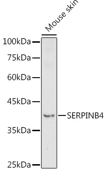 Western blot analysis of extracts of Mouse skin using SERPINB4 Polyclonal Antibody at 1:1000 dilution.