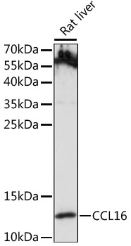 Western blot analysis of extracts of Rat liver using CCL16 Polyclonal Antibody at 1:1000 dilution.