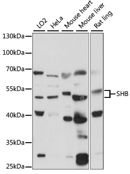 Western blot analysis of extracts of various cell lines using SHB Polyclonal Antibody at 1:1000 dilution.