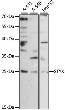 Western blot analysis of extracts of various cell lines using STYX Polyclonal Antibody at 1:1000 dilution.