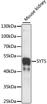 Western blot analysis of extracts of Mouse kidney using SYT5 Polyclonal Antibody at 1:1000 dilution.