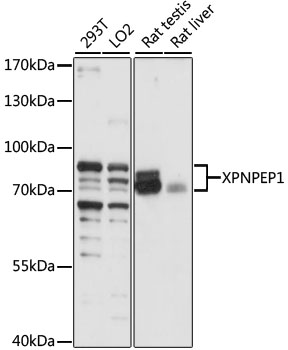 Western blot analysis of extracts of various cell lines using XPNPEP1 Polyclonal Antibody at 1:1000 dilution.