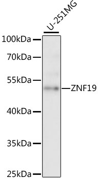 Western blot analysis of extracts of U-251MG cells using ZNF19 Polyclonal Antibody at 1:1000 dilution.