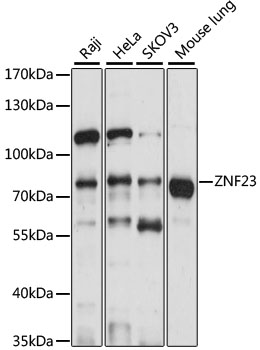 Western blot analysis of extracts of various cell lines using ZNF23 Polyclonal Antibody at 1:1000 dilution.