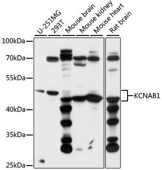 Western blot analysis of extracts of various cell lines using KCNAB1 Polyclonal Antibody at 1:1000 dilution.