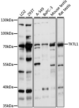 Western blot analysis of extracts of various cell lines using TKTL1 Polyclonal Antibody at 1:1000 dilution.