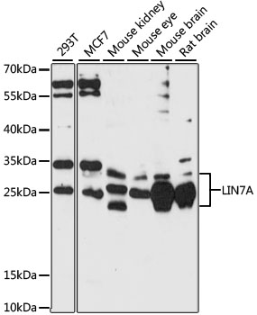 Western blot analysis of extracts of various cell lines using LIN7A Polyclonal Antibody at 1:1000 dilution.