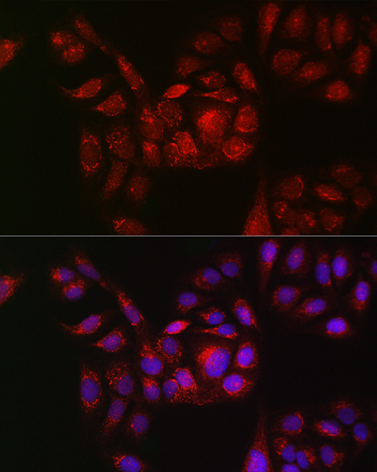 Immunofluorescence analysis of U2OS cells using RAB11B Polyclonal Antibody at dilution of 1:100 (40x lens). Blue: DAPI for nuclear staining.