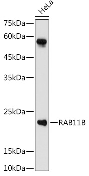 Western blot analysis of extracts of HeLa cells using RAB11B Polyclonal Antibody at 1:1000 dilution.