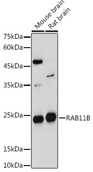 Western blot analysis of extracts of various cell lines using RAB11B Polyclonal Antibody at 1:1000 dilution.