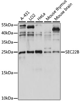 Western blot analysis of extracts of various cell lines using SEC22B Polyclonal Antibody at 1:1000 dilution.