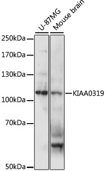 Western blot analysis of extracts of various cell lines using KIAA0319 Polyclonal Antibody at 1:1000 dilution.