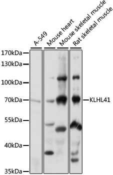 Western blot analysis of extracts of various cell lines using KLHL41 Polyclonal Antibody at 1:1000 dilution.