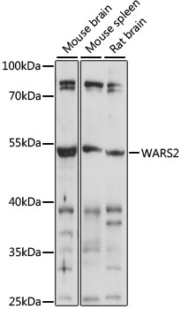 Western blot analysis of extracts of various cell lines using WARS2 Polyclonal Antibody at 1:1000 dilution.