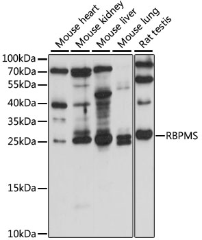 Western blot analysis of extracts of various cell lines using RBPMS Polyclonal Antibody at 1:1000 dilution.