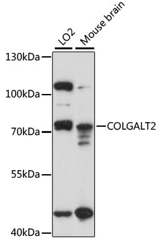 Western blot analysis of extracts of various cell lines using COLGALT2 Polyclonal Antibody at 1:1000 dilution.