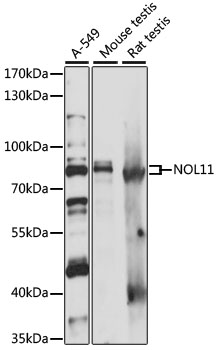 Western blot analysis of extracts of various cell lines using NOL11 Polyclonal Antibody at 1:1000 dilution.