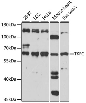 Western blot analysis of extracts of various cell lines using TKFC Polyclonal Antibody